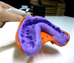 ortodont 3d-tisk